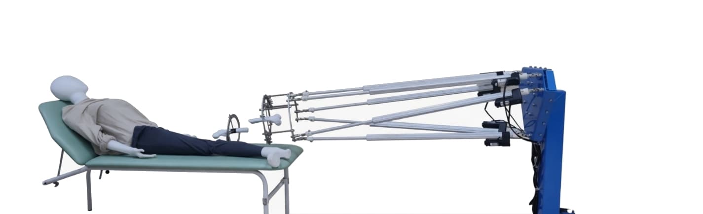 Femur fracture reduction robotics
